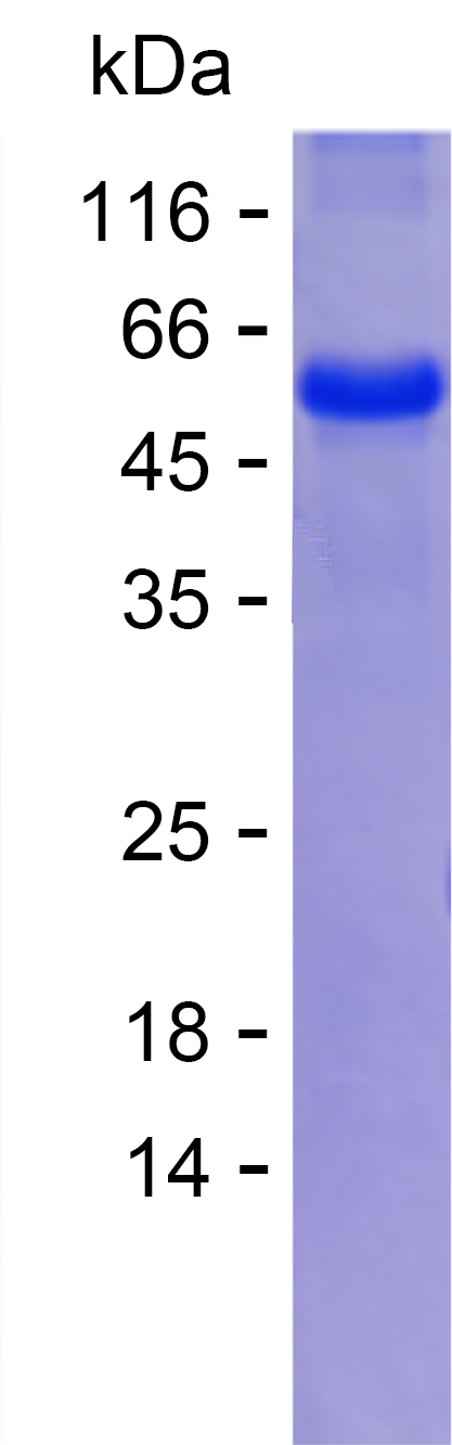 Recombinant Human MED17 Protein - 爱博生Absea | 广州特诺生物_Tenuobiotechnology